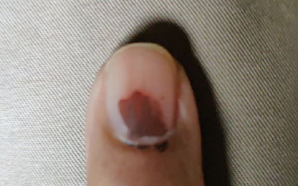 Election Reform